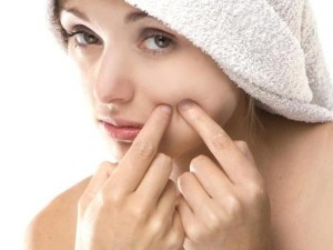 9 Myths and Facts about Acne